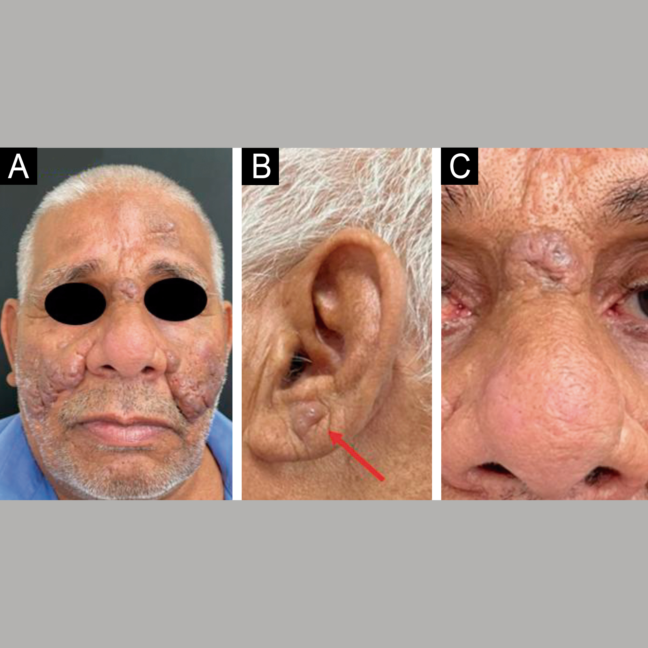 Importância do perfil de textura e sensorial no desenvolvimento de formulações cosméticas
